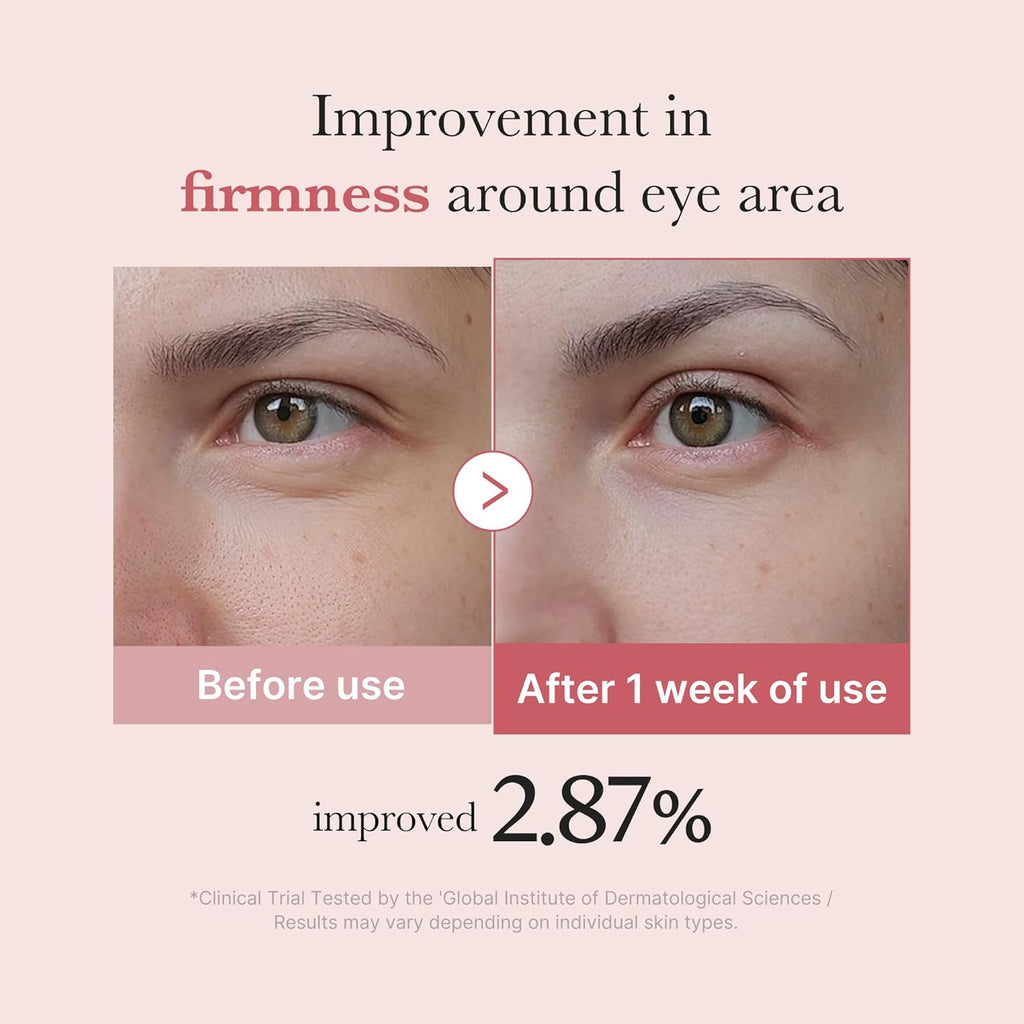 Medicube Crème pour les yeux PDRN Pink Peptide
