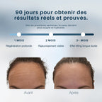 Mycollagénlift